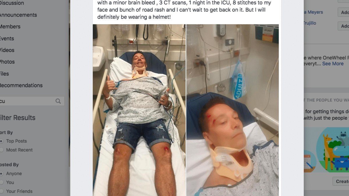 Severe Trauma: From Onewheel To ER To ICU & Lessons Learned