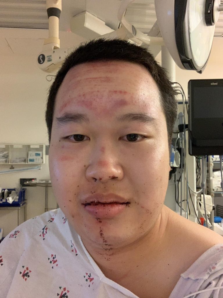 Broken-Wolf-Warrior-Austin-Quon-768x1024